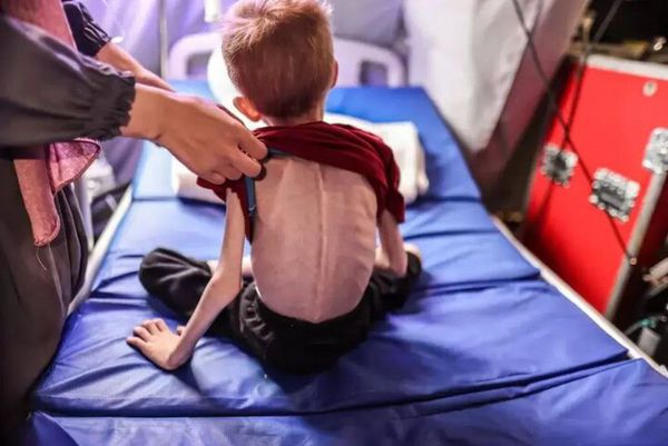 Gaza Health Ministry: 650,000 children on the verge of death