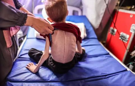 وزارت بهداشت غزه: ۶۵۰ هزار کودک در آستانه مرگ هستند
